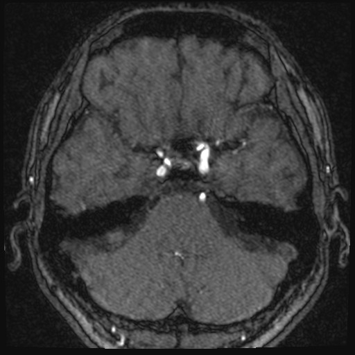 Click on the Serie image to view the images of VILLANUEVA, WILLIAM A.